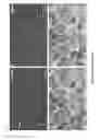 Fig. 10 - Neurotherapeutic nanoparticle compositions comprising leukemia inhibitory factor