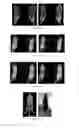 Fig. 07 - PSMA binding ligand-linker conjugates and methods for using