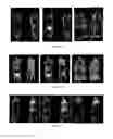 Fig. 08 - PSMA binding ligand-linker conjugates and methods for using