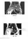 Fig. 04 - MRI CONTRAST AGENT AND METHOD FOR PREPARING THE SAME