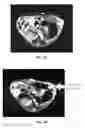 Fig. 05 - MRI CONTRAST AGENT AND METHOD FOR PREPARING THE SAME