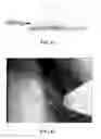 Fig. 47 - Compositions comprising silk fibroin particles and uses thereof
