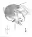Fig. 09 - Patient interface with a seal-forming structure having varying thickness