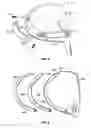 Fig. 07 - CG height adjustability by conformal weighting