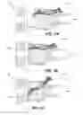 Fig. 08 - Methods of applying materials over fastener heads protruding from non-horizontal surfaces