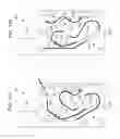 Fig. 12 - Transport apparatus