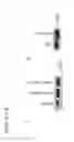 Fig. 12 - Compositions and methods for inhibiting cancer stem cells