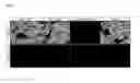 Fig. 15 - HER2 BINDING PROTEINS BASED ON DI-UBIQUITIN MUTEINS