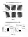 Fig. 11 - Methods and compositions for treatment of atherosclerosis