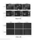 Fig. 09 - LIN28- MEDIATED CONTROL OF LET-7 BIOGENESIS