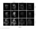 Fig. 02 - MICROVESICLE AND STEM CELL COMPOSITIONS FOR THERAPEUTIC APPLICATIONS