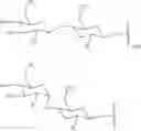 Fig. 178 - Compositions and methods for modulating apolipoprotein (a) expression