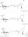 Fig. 93 - Compositions and methods for modulating apolipoprotein (a) expression