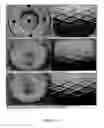 Fig. 06 - Methods for electrospin coating and laminating of endoluminal prostheses