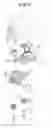 Fig. 09 - Washing Machine, Micro-Bubble Generator Thereof, and Method for Supplying Wash Water Including Micro-Bubbles in a Washing Machine