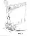 Fig. 09 - DRAGLINE BUCKET RIGGING WITH ACTIVE TILT DEVICE