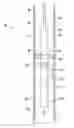 Fig. 01 - Prevention of gas accumulation above ESP intake