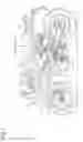 Fig. 02 - Cylinder head of internal combustion engine