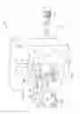Fig. 02 - Patient-mounted or patient support-mounted camera for position monitoring during medical procedures