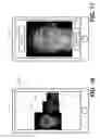 Fig. 07 - Methods for age appearance simulation