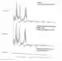 Fig. 05 - Relative excitation features for speech recognition