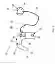Fig. 03 - Cochlear hearing device with cable antenna