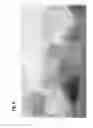 Fig. 07 - Micropropagation of Black Barhee date palm