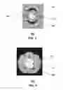 Fig. 02 - METHODS, SYSTEMS AND DEVICES TO PROVIDE PHYSICAL SECURITY TO WAVEGUIDES