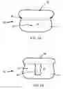Fig. 09 - Clip-on pouch
