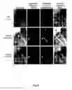 Fig. 07 - PROTOPORPHYRIN IX (PPIX) IMAGING