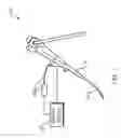 Fig. 02 - Guide sheath with window and markings indicating location thereof