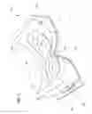 Fig. 02 - Medical interfaces and other medical devices, systems, and methods for performing eye exams