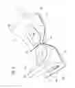 Fig. 06 - Medical interfaces and other medical devices, systems, and methods for performing eye exams