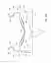 Fig. 40 - Medical interfaces and other medical devices, systems, and methods for performing eye exams