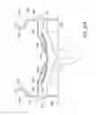 Fig. 43 - Medical interfaces and other medical devices, systems, and methods for performing eye exams