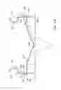Fig. 45 - Medical interfaces and other medical devices, systems, and methods for performing eye exams