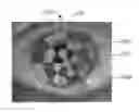 Fig. 01 - Full-eye illumination ocular surface imaging of an ocular tear film for determining tear film thickness and/or providing ocular topography