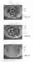 Fig. 08 - Full-eye illumination ocular surface imaging of an ocular tear film for determining tear film thickness and/or providing ocular topography