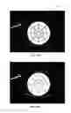 Fig. 22 - Full-eye illumination ocular surface imaging of an ocular tear film for determining tear film thickness and/or providing ocular topography