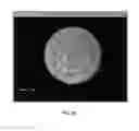 Fig. 23 - Full-eye illumination ocular surface imaging of an ocular tear film for determining tear film thickness and/or providing ocular topography