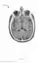 Fig. 05 - Method, system and apparatus for image-guided insertion of implant devices