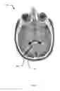Fig. 07 - Method, system and apparatus for image-guided insertion of implant devices