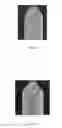 Fig. 08 - Method, system and apparatus for image-guided insertion of implant devices