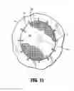 Fig. 07 - Surgical implants including sensing fibers