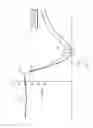 Fig. 02 - METHOD AND SYSTEM FOR DIAGNOSTIC PUPILLOMETRIC ASSESSMENT OF TRAUMATIC BRAIN INJURY