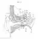 Fig. 02 - Evaluation of an implanted prosthesis
