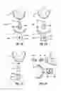 Fig. 02 - Appliance for dental navigation