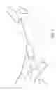 Fig. 09 - Device and methods for use in robotic assisted surgery for treatment of obstructive sleep apnea