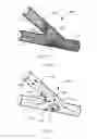 Fig. 08 - Vessel shaping devices and methods