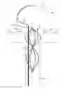 Fig. 01 - Vascular remodeling device